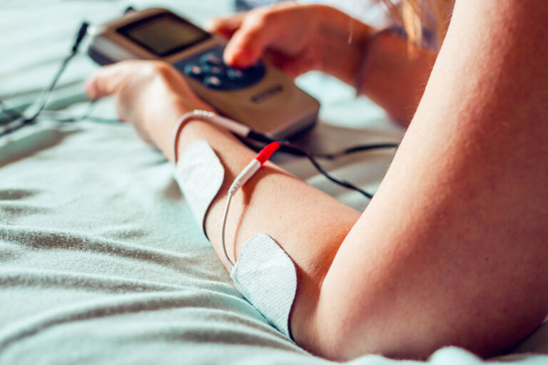 electroestimulación percutánea